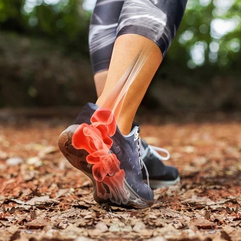 Achilles-ín tendinopátia