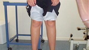 Elülső vizsgálati nézet