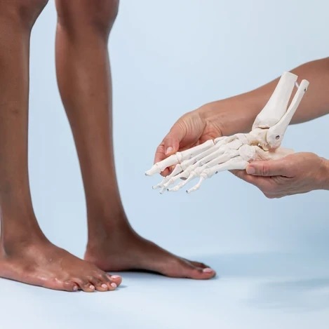 esettanulmány Fibromyalgia